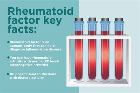 Rheumatoid Factor: What It Is, Test Details & Normal Range